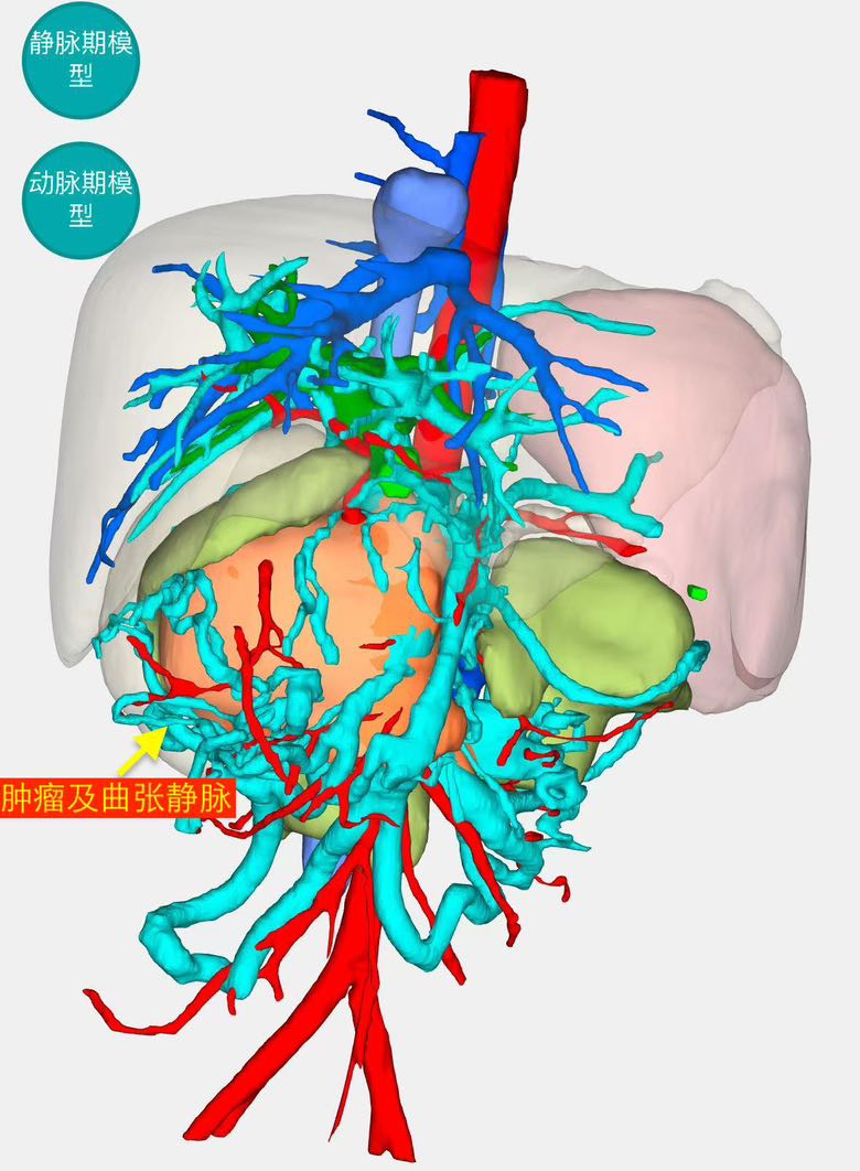 9148CFC3-68C1-4146-AE01-6169B8DCD45F